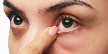 دراسة
      علمية
      جديدة
      تكشف
      أسباب
      جفاف
      العين