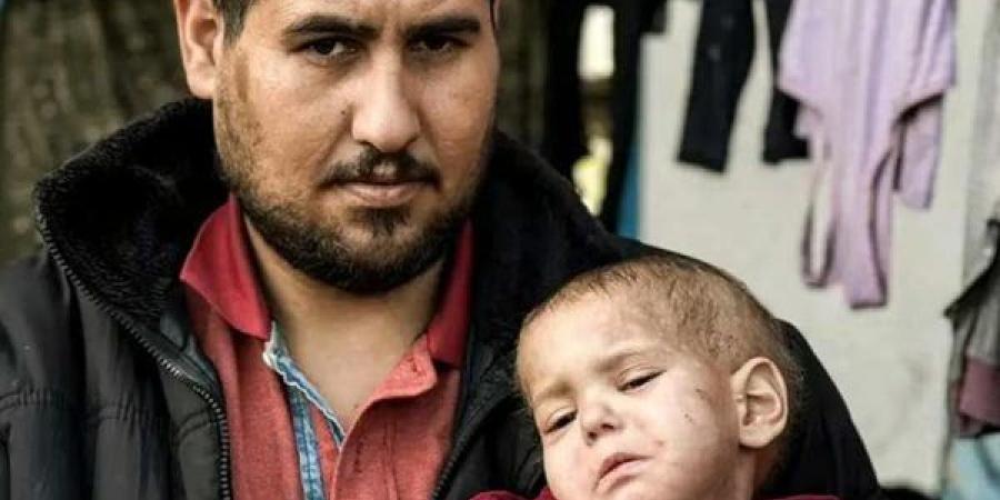 الحرب
      دمرت
      رحلة
      علاجها..
      فلسطيني
      عن
      ابنته
      المريضة:
      أخشى
      أن
      أستيقظ
      وأجدها
      ميتة