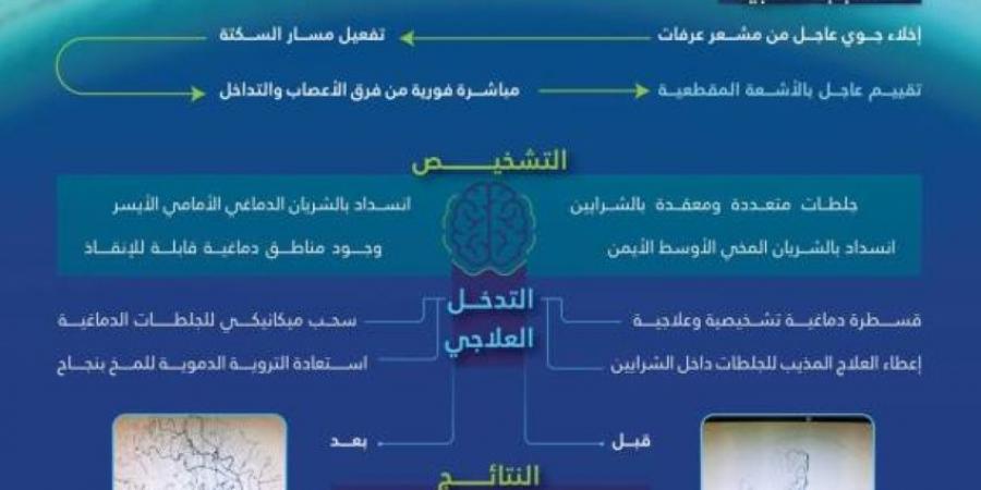 عبدالله الطبية تنقذ حاجة إندونيسية من سكتة دماغية معقدة - المساء الاخباري